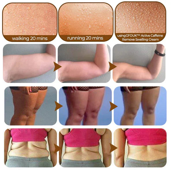 CafeLuxe - Remove Swelling Cream