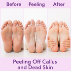 Hydrating Foot Peeling Mask