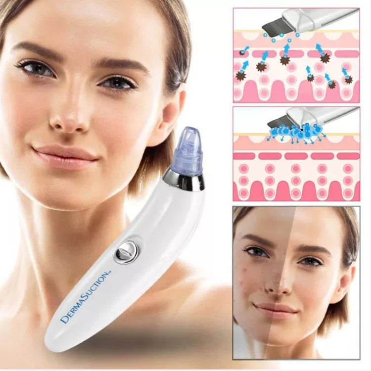Blackhead Remover - Face Vacuum Suction