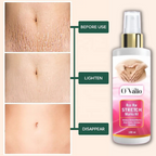 MarkLess Strech Guard Oil Pack of 2(100mlx2)